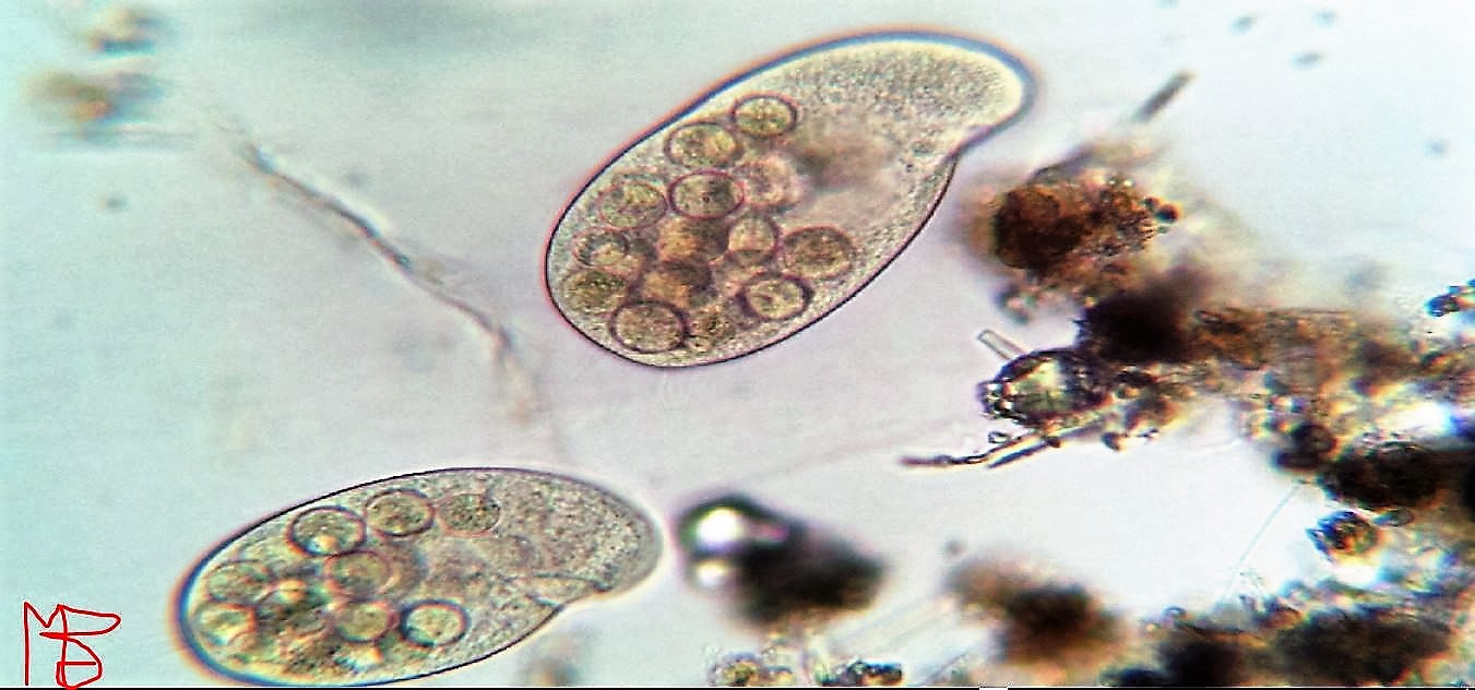 protozoo ciliato da determinare